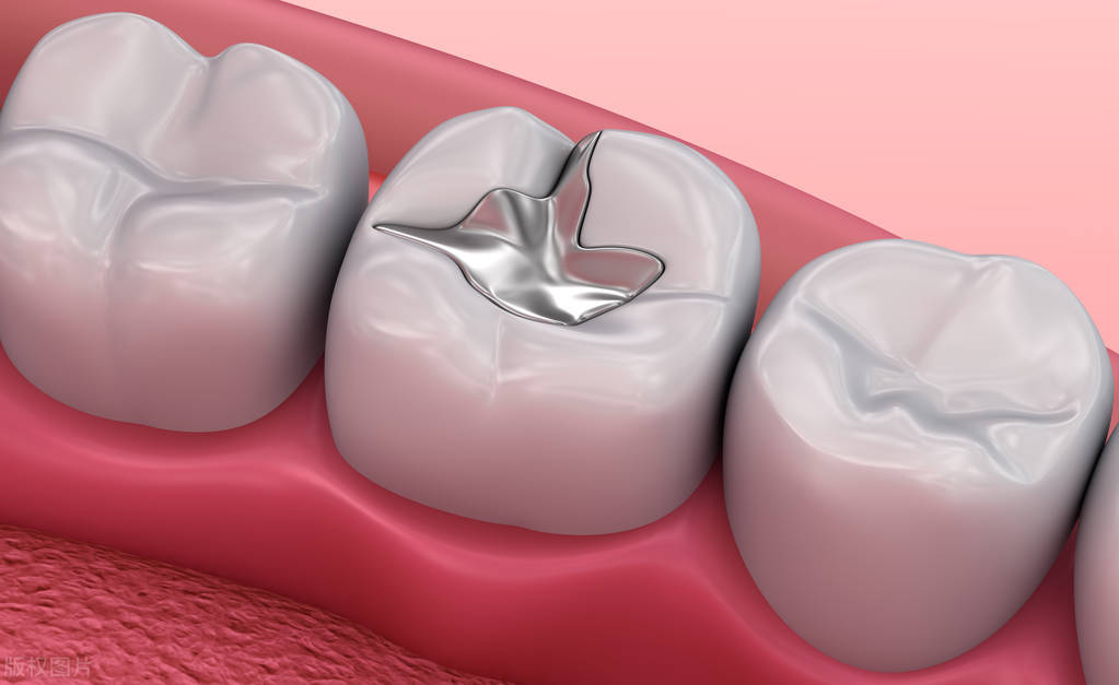 一般医院看牙多少钱,去医院看一次牙大概多少钱