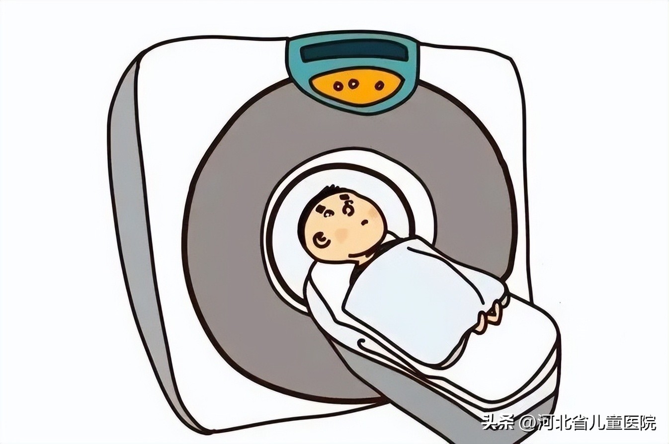 左侧睾丸附件扭转,附件扭转是什么导致的