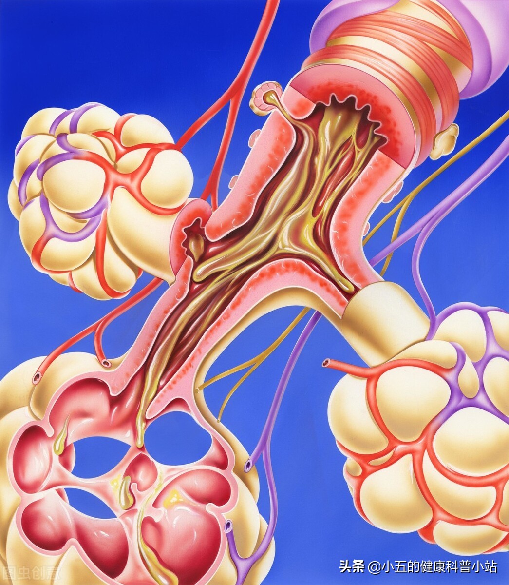 乙酰半胱氨酸片有抗炎作用吗,乙酰半胱氨酸片可用于雾化吗