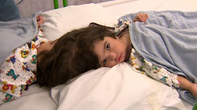 连体姐妹一人结婚现在如何,雌雄连体人结婚怎么办