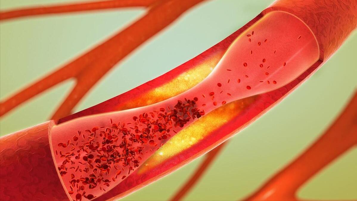 伟哥心脏的副作用停药后能恢复吗,伟哥吃久了有什么副作用