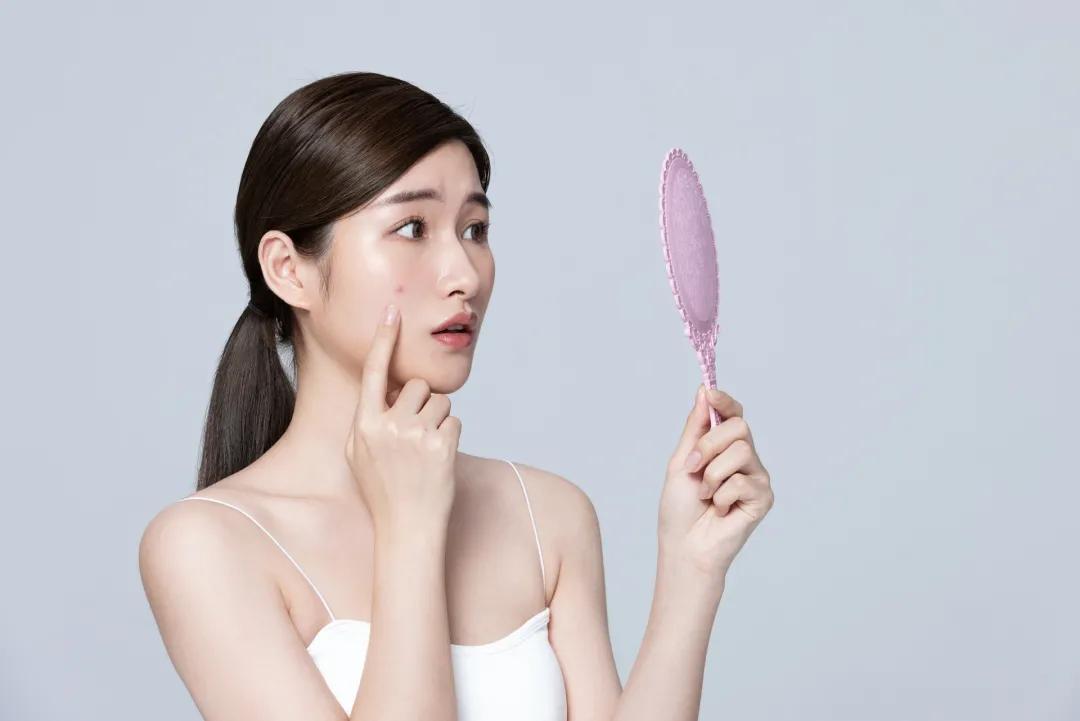 如何健脾胃去除痘痘,治疗痘痘的食补