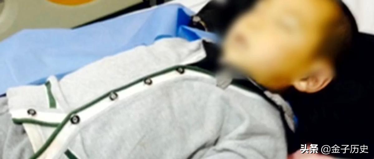 3岁男孩补牙途中意外身亡,3岁男孩补牙死亡