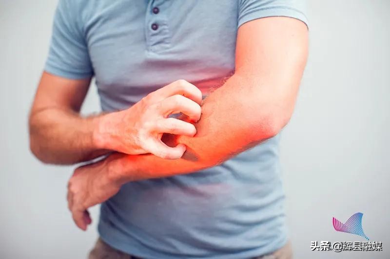 河南辉县丨为什么一到冬天就浑身瘙痒？别挠！缓解办法拿走不谢辉县市融媒体中心