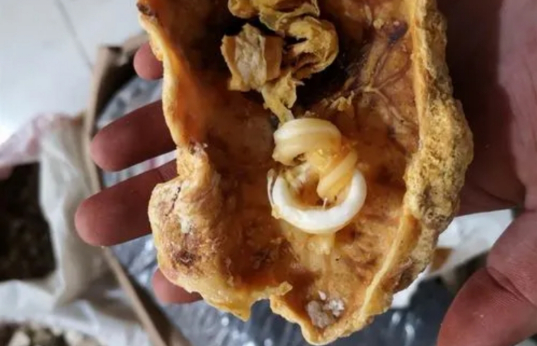 “人体胎盘”交易曝光，价格不菲！食用人类胎盘，滋补还是作死？