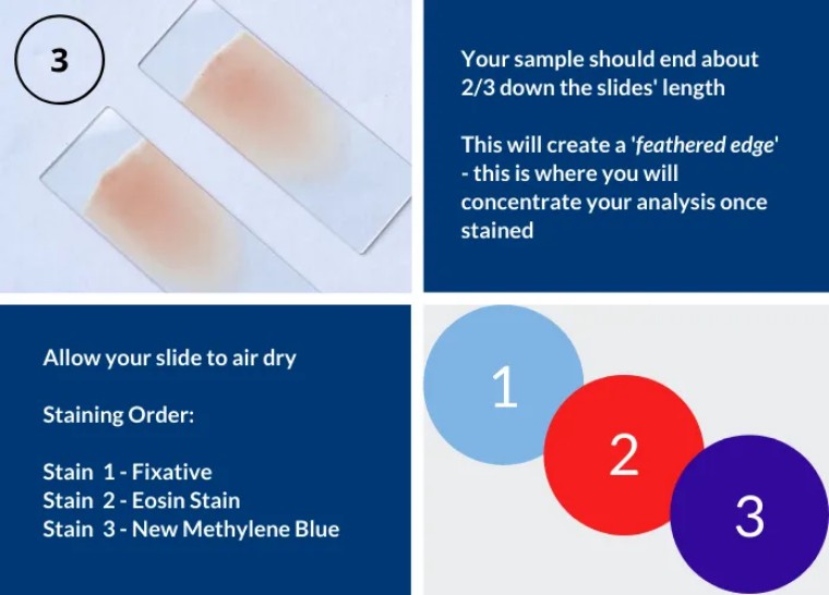 血涂片染色教程,人工涂片染色的步骤