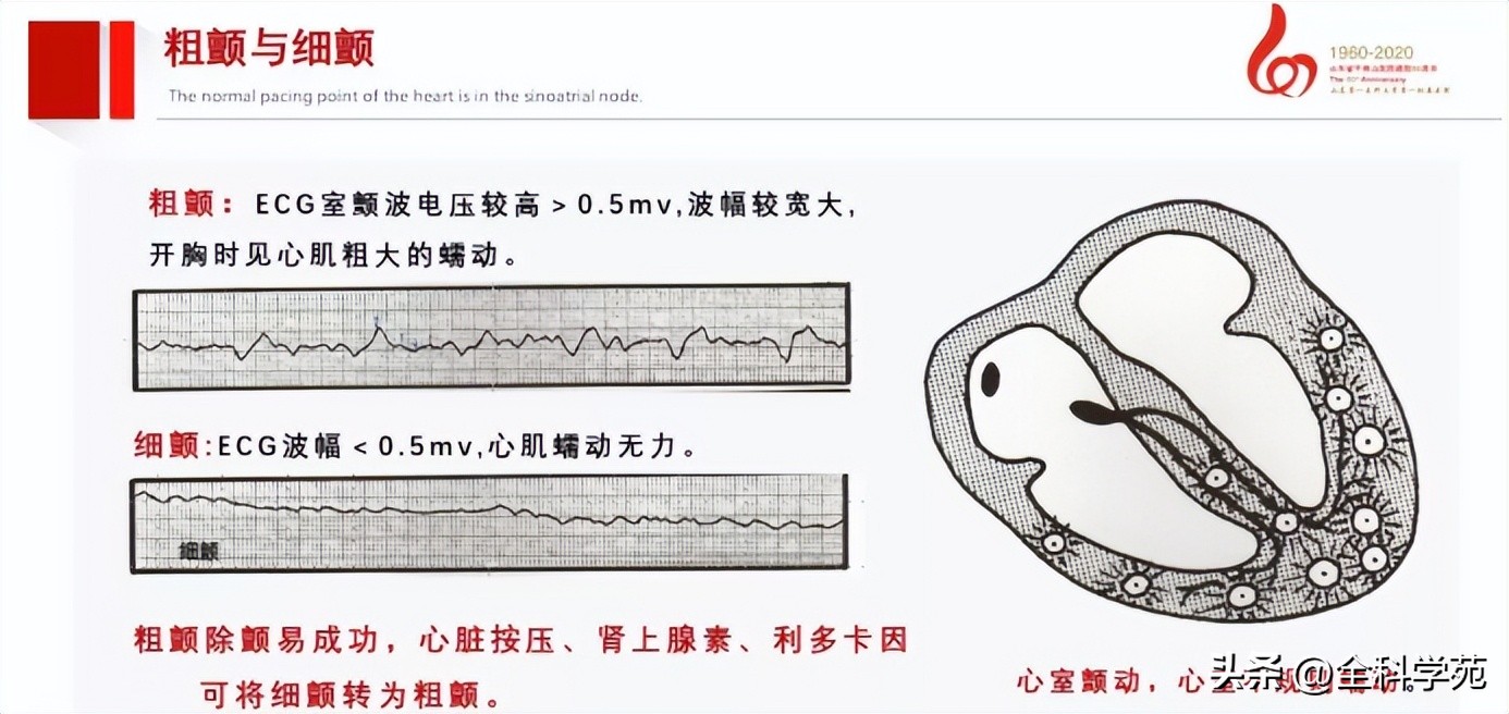 急救除颤仪麦邦aed7000,急救心脏除颤仪使用方法