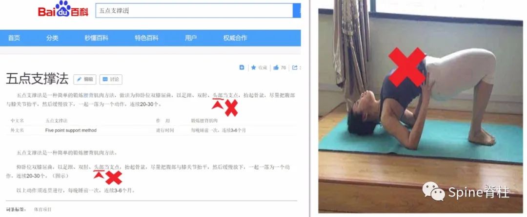 腰椎间盘突出症状表现,腰椎间盘突出症疼痛最佳止痛方法