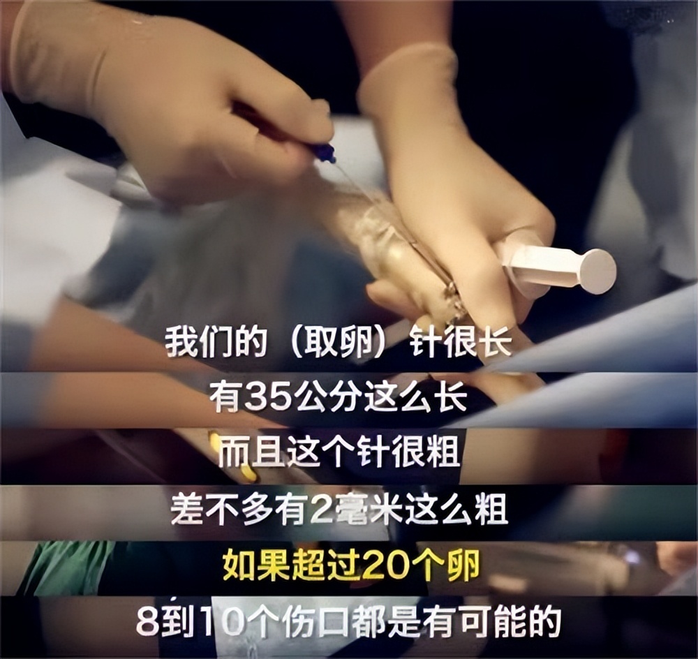 *市黑**卖卵，非法代孕，不打麻药穿刺下身：女大学生要小心卖卵*局骗**