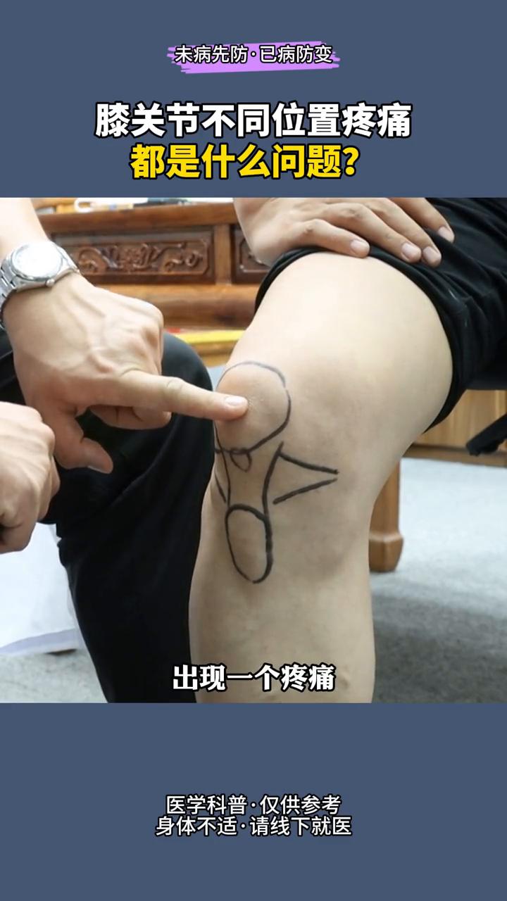 膝关节不同位置的疼痛都是什么问题？#医学科普