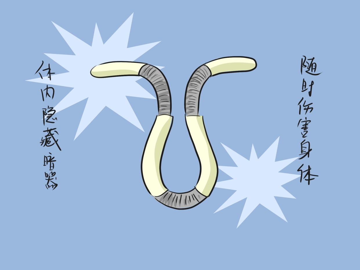 取节育环真的有危险吗,节育环长肉里还取的下来么