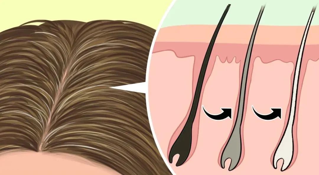 走近科学治白发,冷知识科普白发