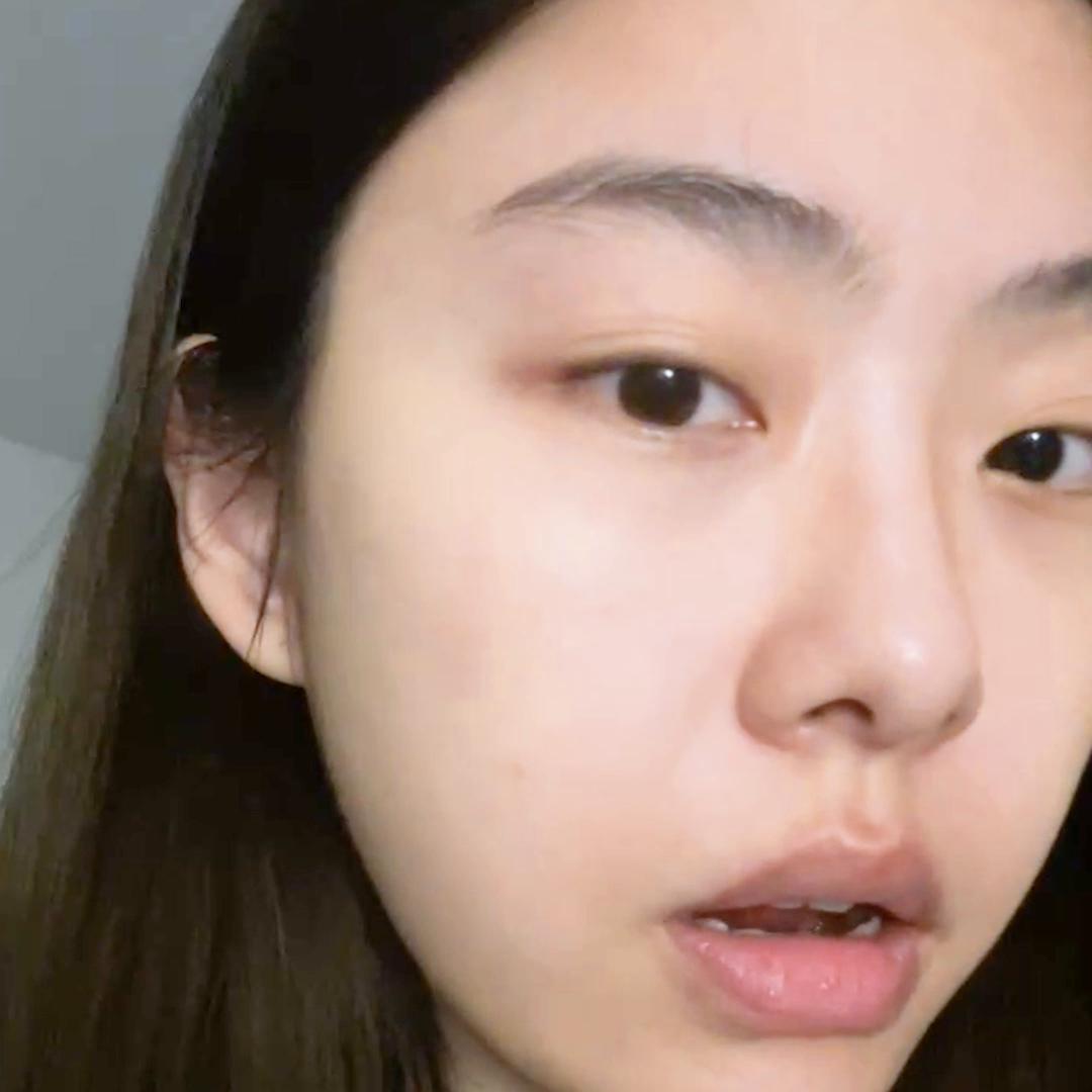 你们一直问我do脸恢复期要怎么做！都用什么！#美商