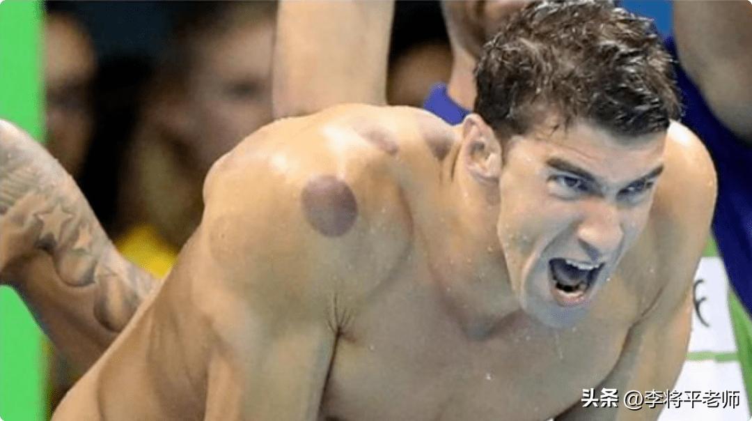 美国士兵拔火罐,美军晒拔火罐照片