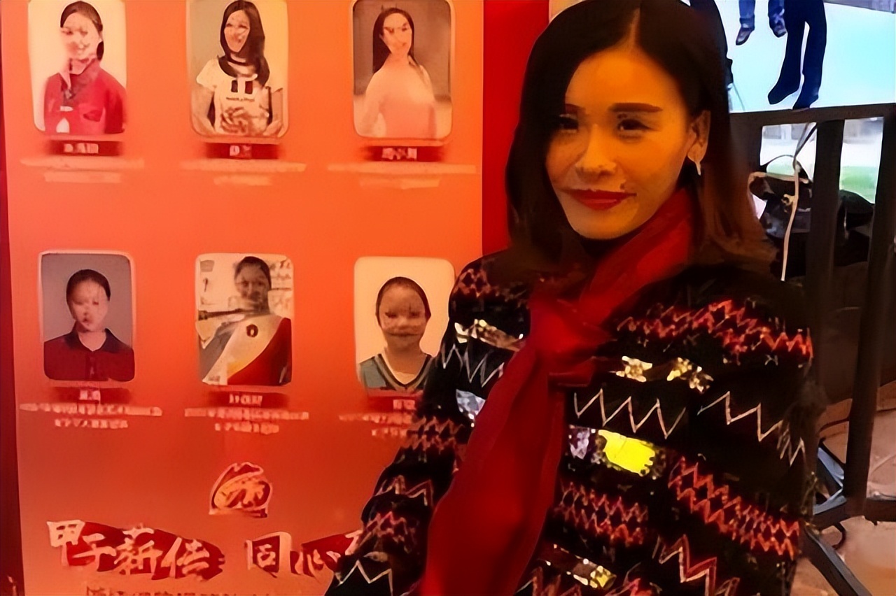 体操冠军桑兰瘫痪25年，自爆一年用2000根导尿管，打出租车遭拒载