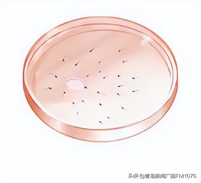 揭秘试管婴儿孕育全过程,试管婴儿诞生原理