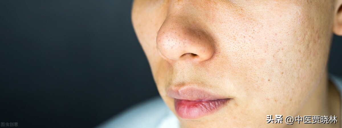 治肝的一味中药,治肝之病必先实脾