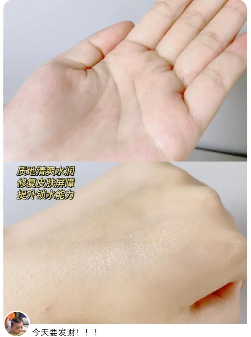 敏感肌比较适合的护肤品,有哪些适合敏感肌使用的护肤品