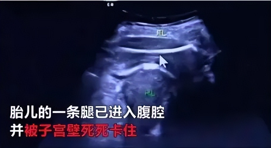 蒋丽莎和陈浩民近况,陈浩民和蒋丽莎最新视频