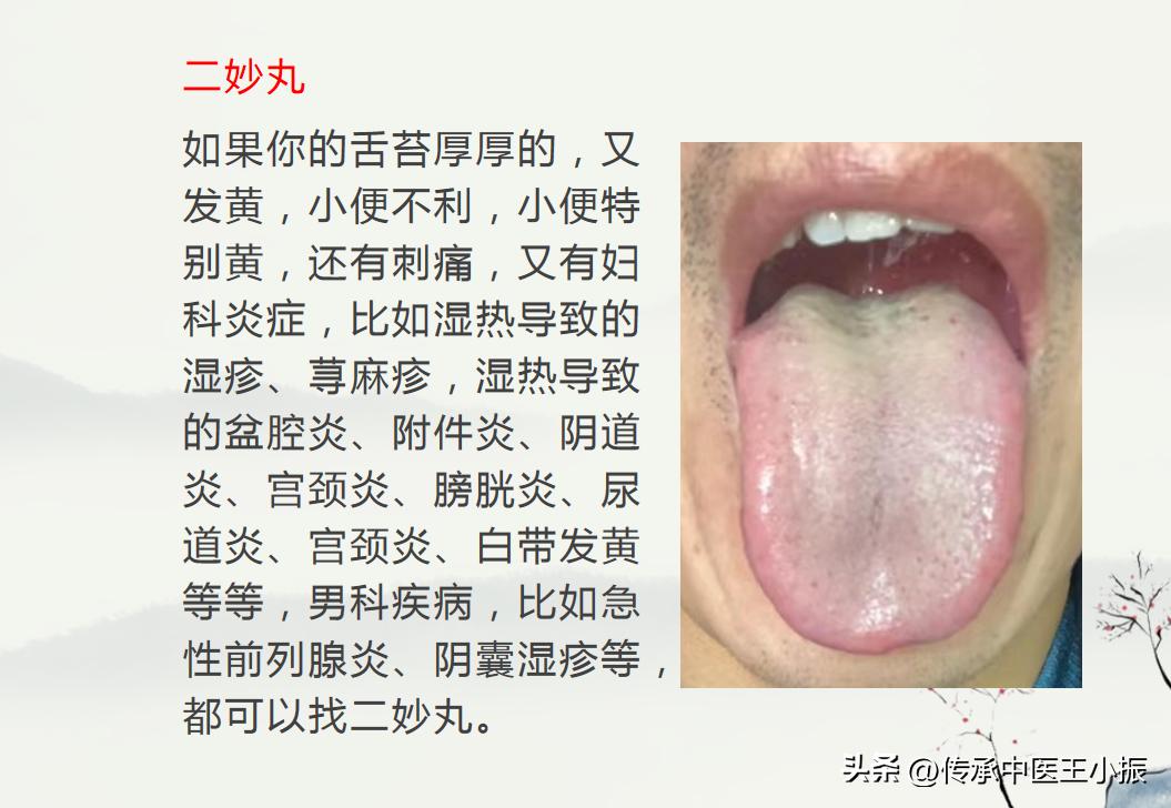 下焦湿热不能吃补气的药吗,下焦湿热不吃药只锻炼能好不