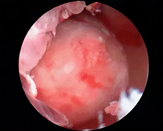好医生被害案例,好医生结局解析