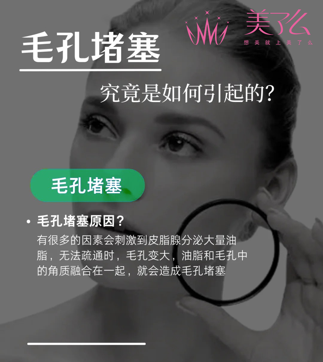 脂溢性皮炎毛孔堵塞如何疏通,疏通毛孔堵塞闭合性粉刺视频