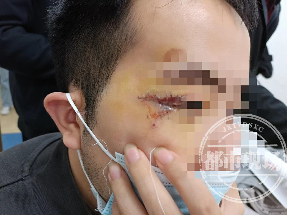 玩密室逃脱摔伤脚踝落下,男子玩密室逃脱摔成残疾