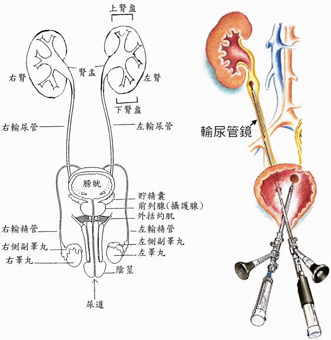 肾结石不疼不代表没有危害，一旦发现要及时就诊！
