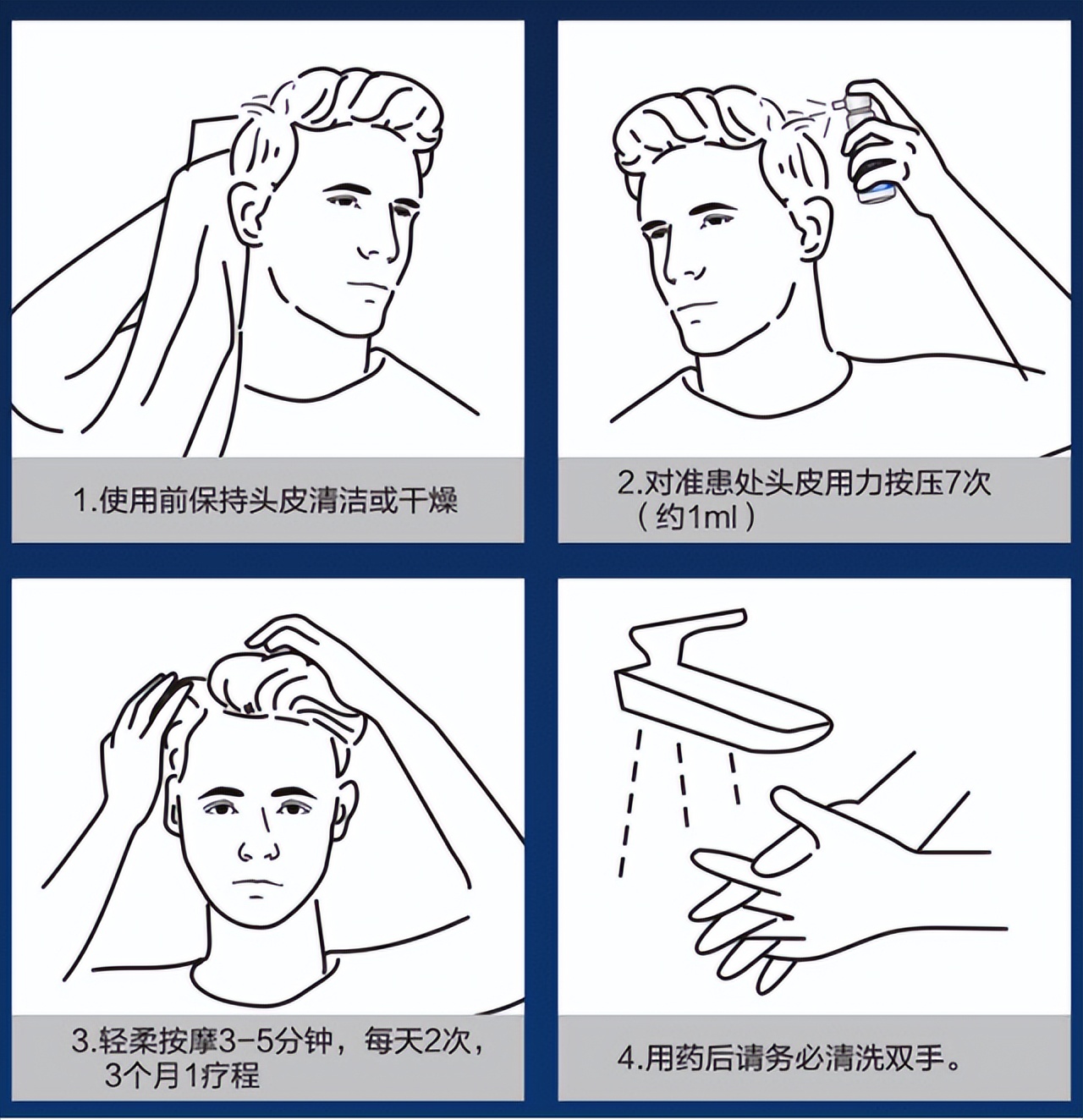 女生脱发是不是都从发缝开始,脱发中分发缝明显怎么办
