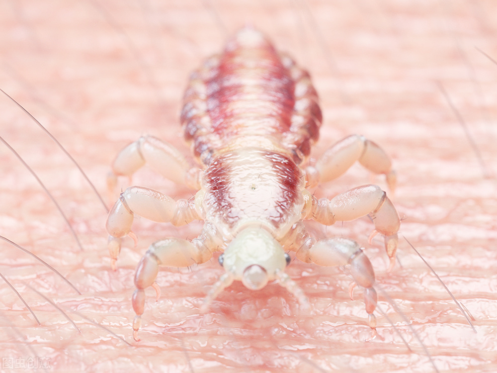 阴虱是什么造成的,阴虱是什么原因造成的呢