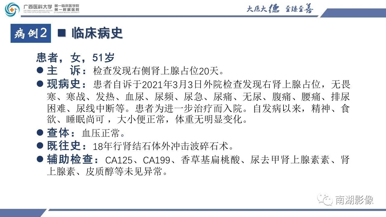 肾上腺海绵状血管瘤,肾上腺血管瘤是良性还是恶性