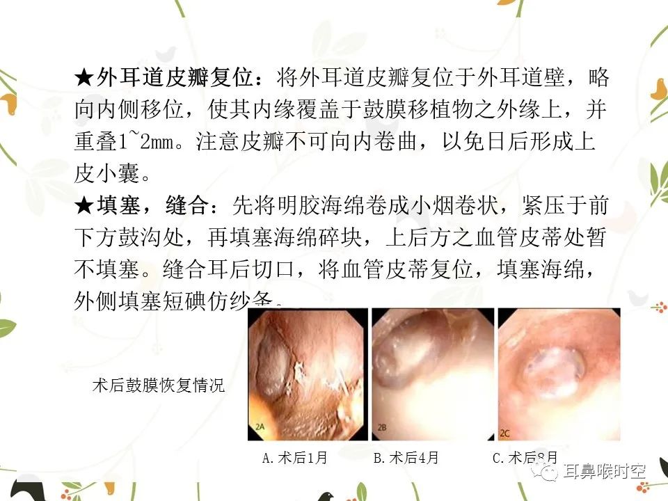 鼓膜可见穿孔,鼓膜穿孔听力下降能恢复吗