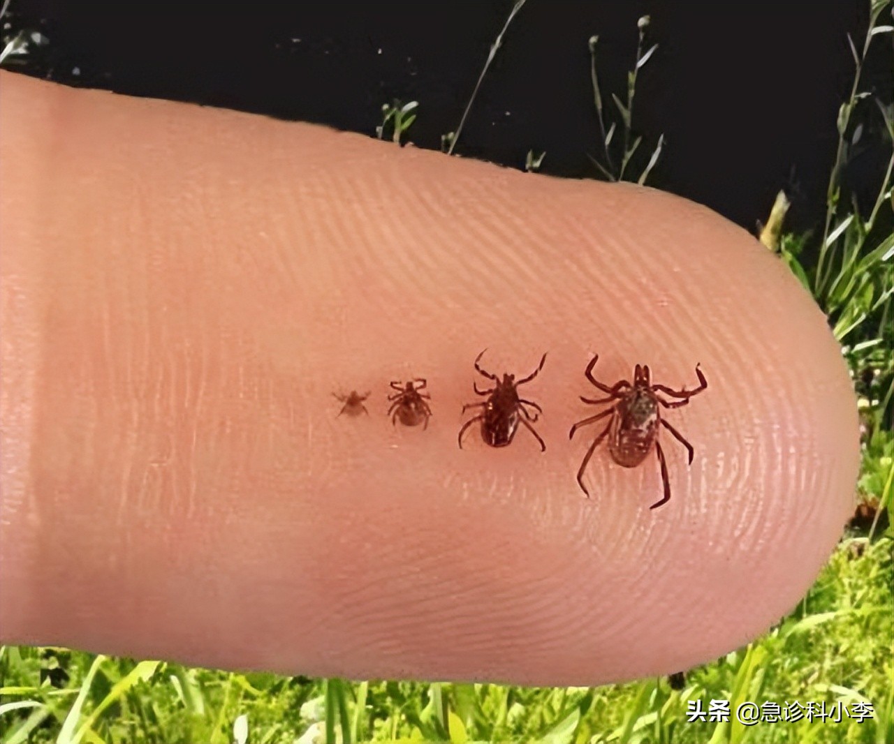 蜱虫咬人死亡率多少,蜱虫咬后死亡率新闻