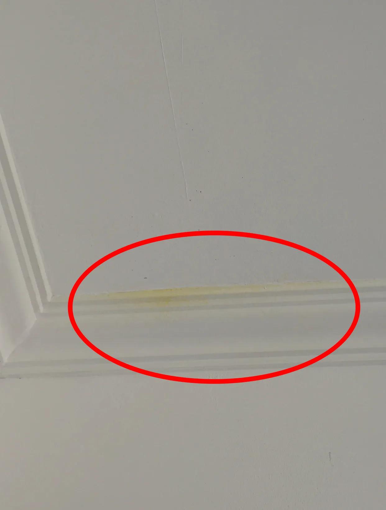 石膏线落伍吗,石膏线为什么不流行了