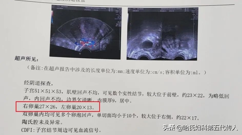 年纪轻轻卵巢早衰怎么补救,没到更年期但是卵巢早衰怎么调理