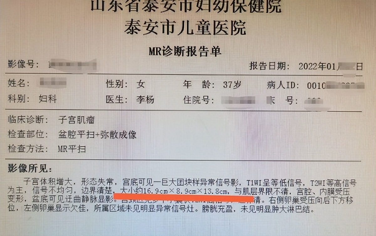 「健康科普」破纪录了！4米长的子宫肌瘤你见过吗？