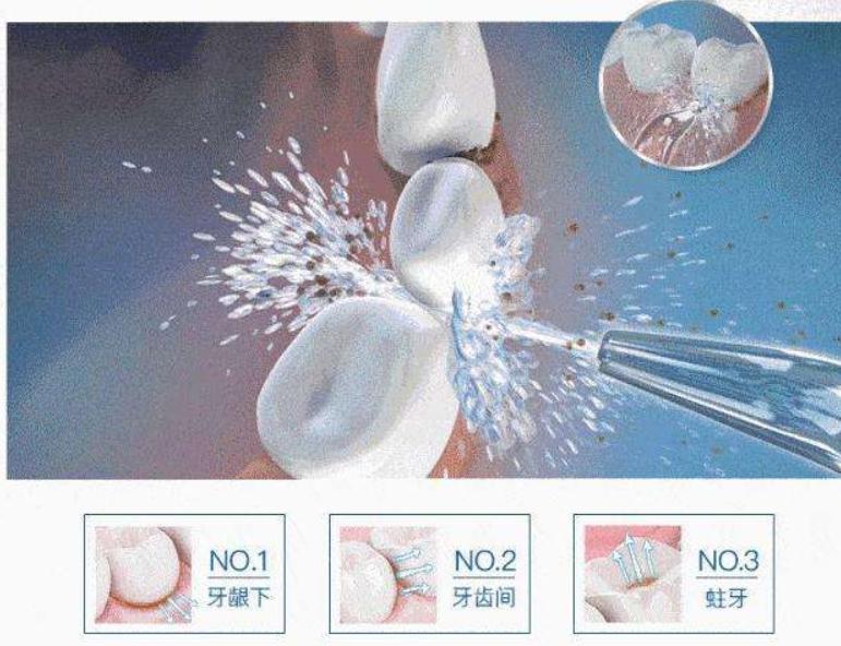 冲牙器的好处和坏处,常用冲牙器对牙齿有害吗