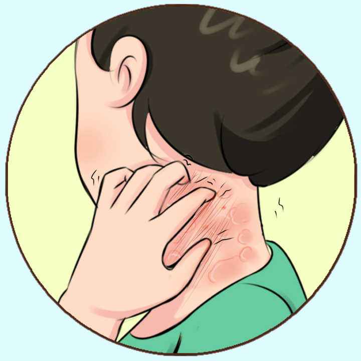 得了湿疹怎么调理身体,湿疹的原因和预防及治疗方法