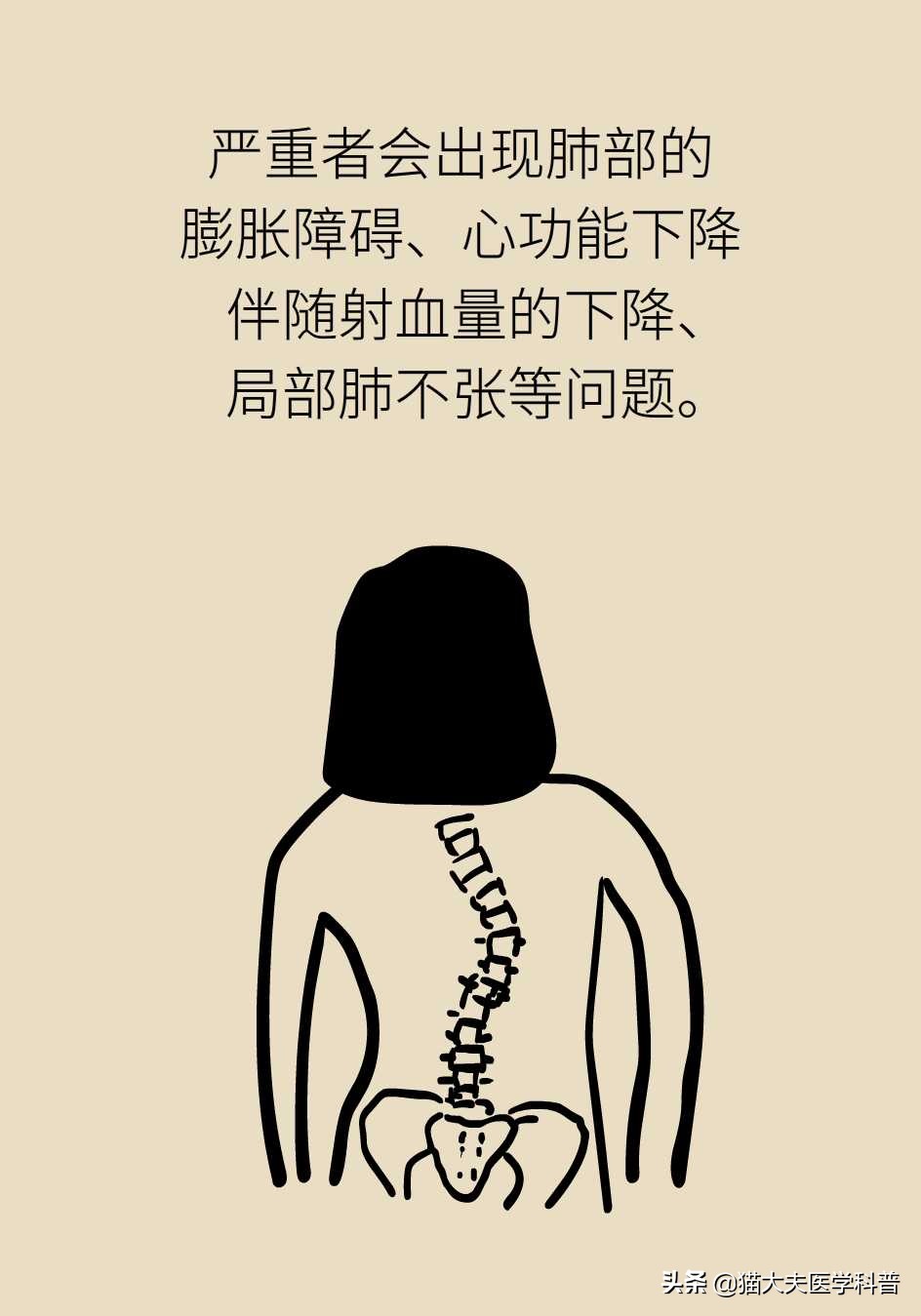 孩子老是驼着背走路感觉没自信,五十岁背有点驼怎么办