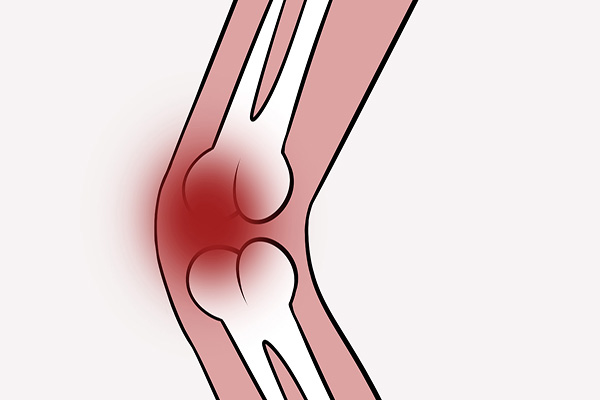 伤筋动骨100天一味静养也不行,伤筋动骨一百天注意什么