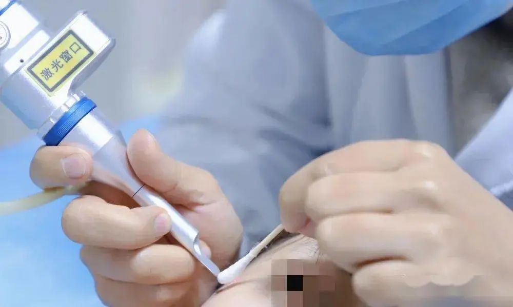 整形医院激光科都有什么项目做的,纳米激光整形术