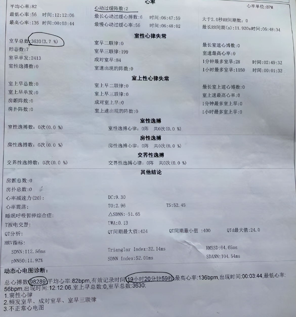 妈妈老是心慌吃什么药,妈妈心律不齐的原因及治疗方法