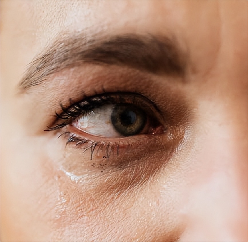 结膜炎畏光流泪还有点模糊怎么办,眼睛怕光迎风流泪结膜炎