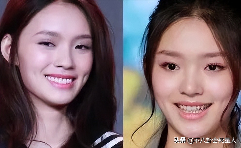 假头发假鼻子,假头发和假肚皮