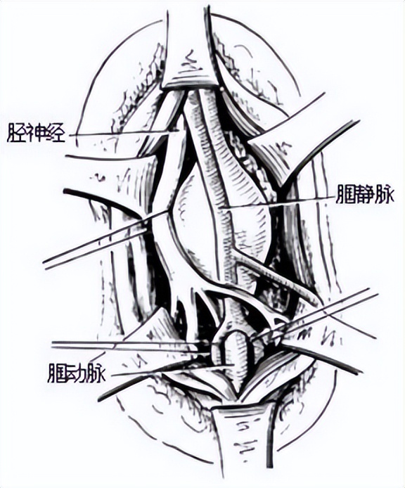 临床血管外科学最新版,血管外科学