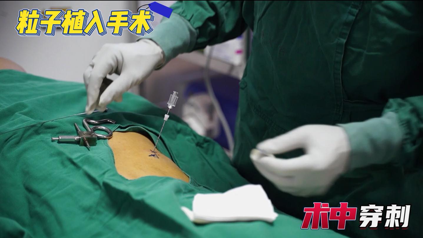 碘125粒子植入全过程展示：一根针将粒子送至肿瘤内部，精准杀癌