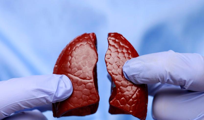 中医消除肺部结节的方法,中医如何调理肺部结节