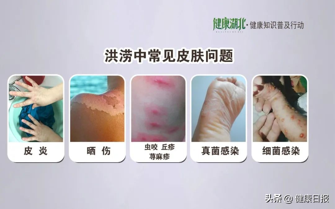 皮肤病的问题全在这里,皮肤病的10大问题