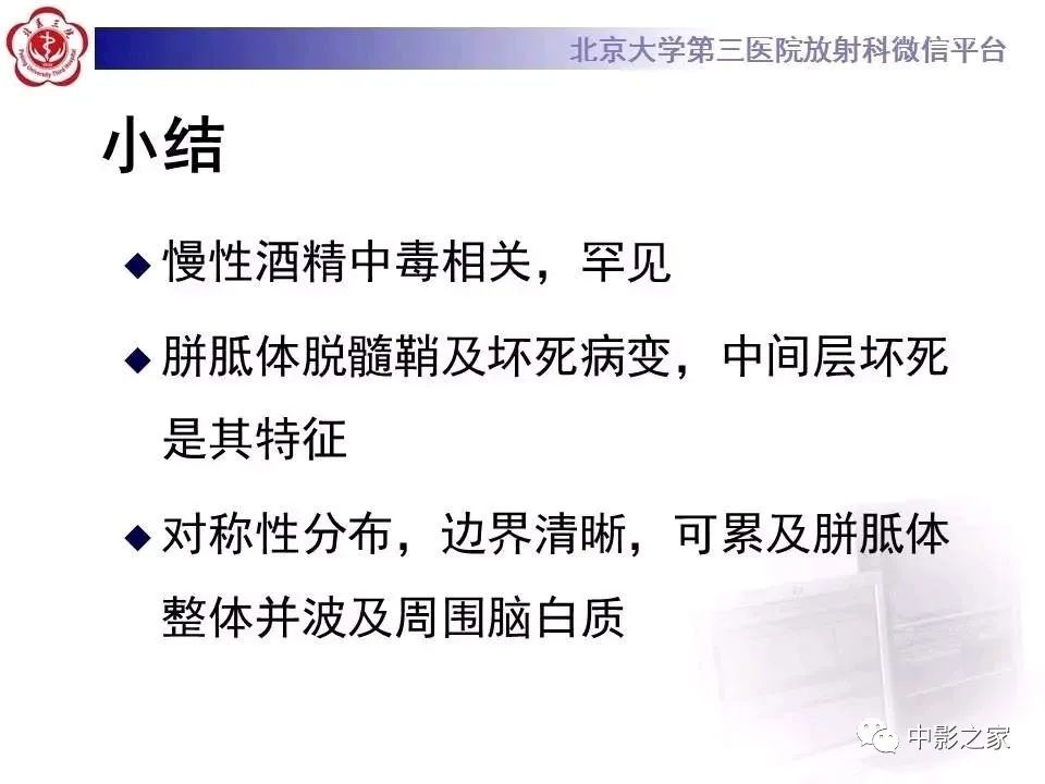 什么叫原发性胼胝体变性,原发性胼胝体变性治疗多少钱