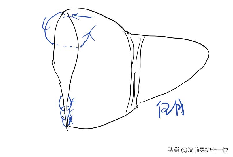 关于急诊清创缝合术必须掌握知识